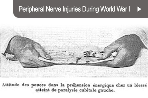 Peripheral Nerve Injuries During World War I